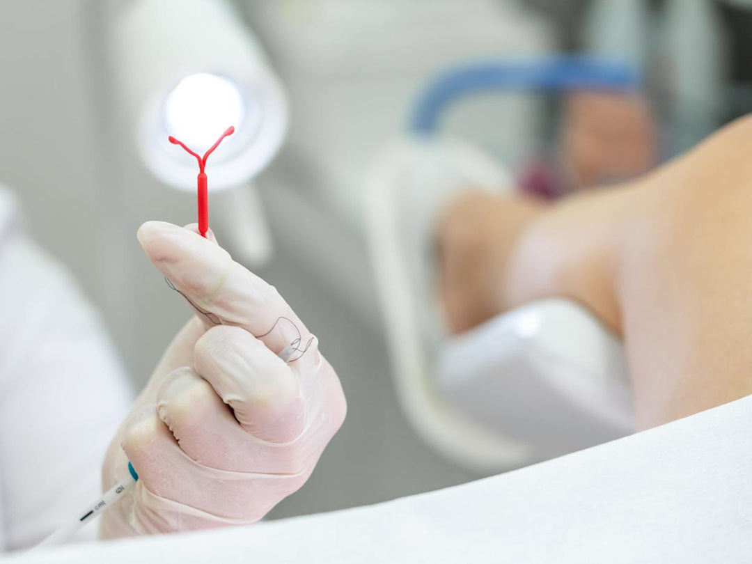 спираль в руках у врача