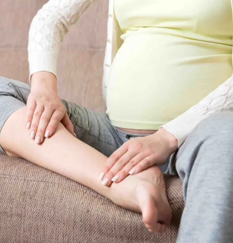 Варикоз на ногах при беременности